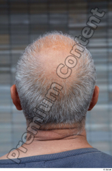 Head Hair Man White Casual Average Bald Street photo references